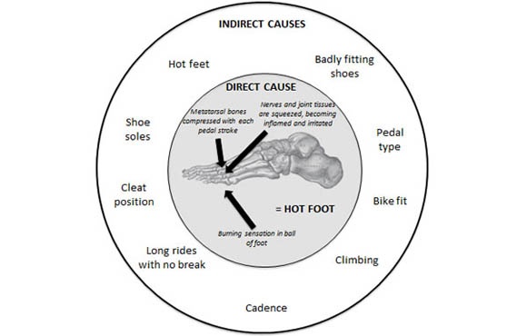 Importance That Bike Shoes Fit Correctly